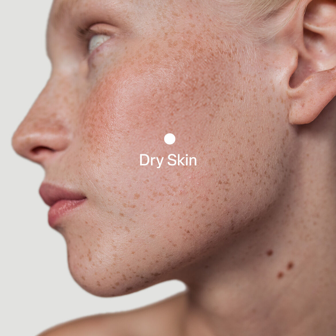 Additional Dry Skin Care Tips
