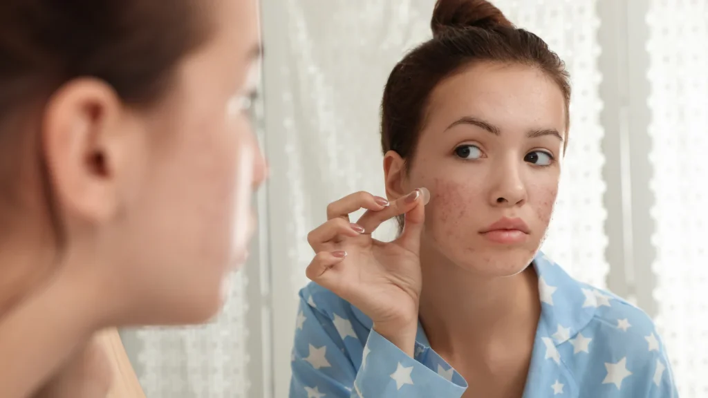 Skin Routine for Teens: A Simple Guide to Healthy Skin