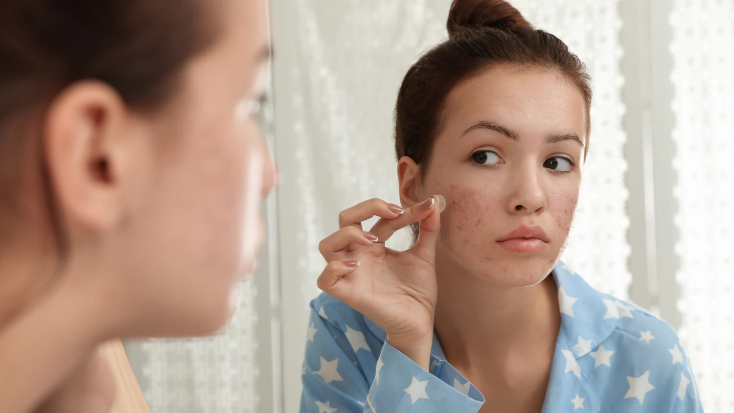 Skin Routine for Teens: A Simple Guide to Healthy Skin